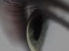 eye